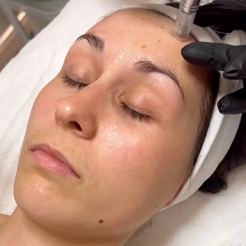 Odos atsinaujinimą skatinanti veido procedūra su egzosomomis